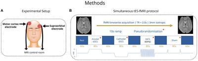 Transcranial electrical stimulation during functional magnetic resonance imaging in patients with genetic generalized epilepsy: a pilot and feasibility study